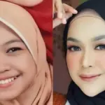 Ria Ricis Buka Suara soal Oplas Hidung: Transformasi Penampilan yang Bikin Heboh Netizen