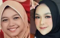 Ria Ricis Buka Suara soal Oplas Hidung: Transformasi Penampilan yang Bikin Heboh Netizen