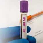 Tes DNA Revolusioner Janjikan Pengurangan Kemoterapi dan Deteksi Dini Kanker, Namun Hasil Campuran di Inggris