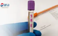 Tes DNA Revolusioner Janjikan Pengurangan Kemoterapi dan Deteksi Dini Kanker, Namun Hasil Campuran di Inggris