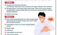 Kematian Temon Akibat Serangan Jantung: Fakta, Reaksi Keluarga, dan Tanda-tanda Awal yang Sering Diabaikan